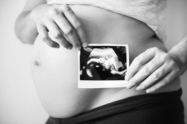 Pregnant woman showing a photo of the foetus of her unborn child