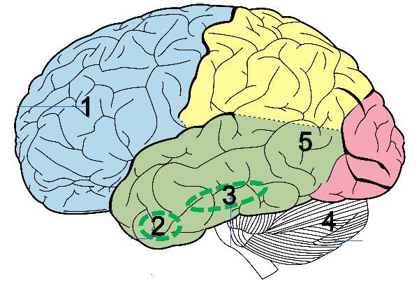 Regions of the brain that when underdeveloped cause autism spectrum disorder